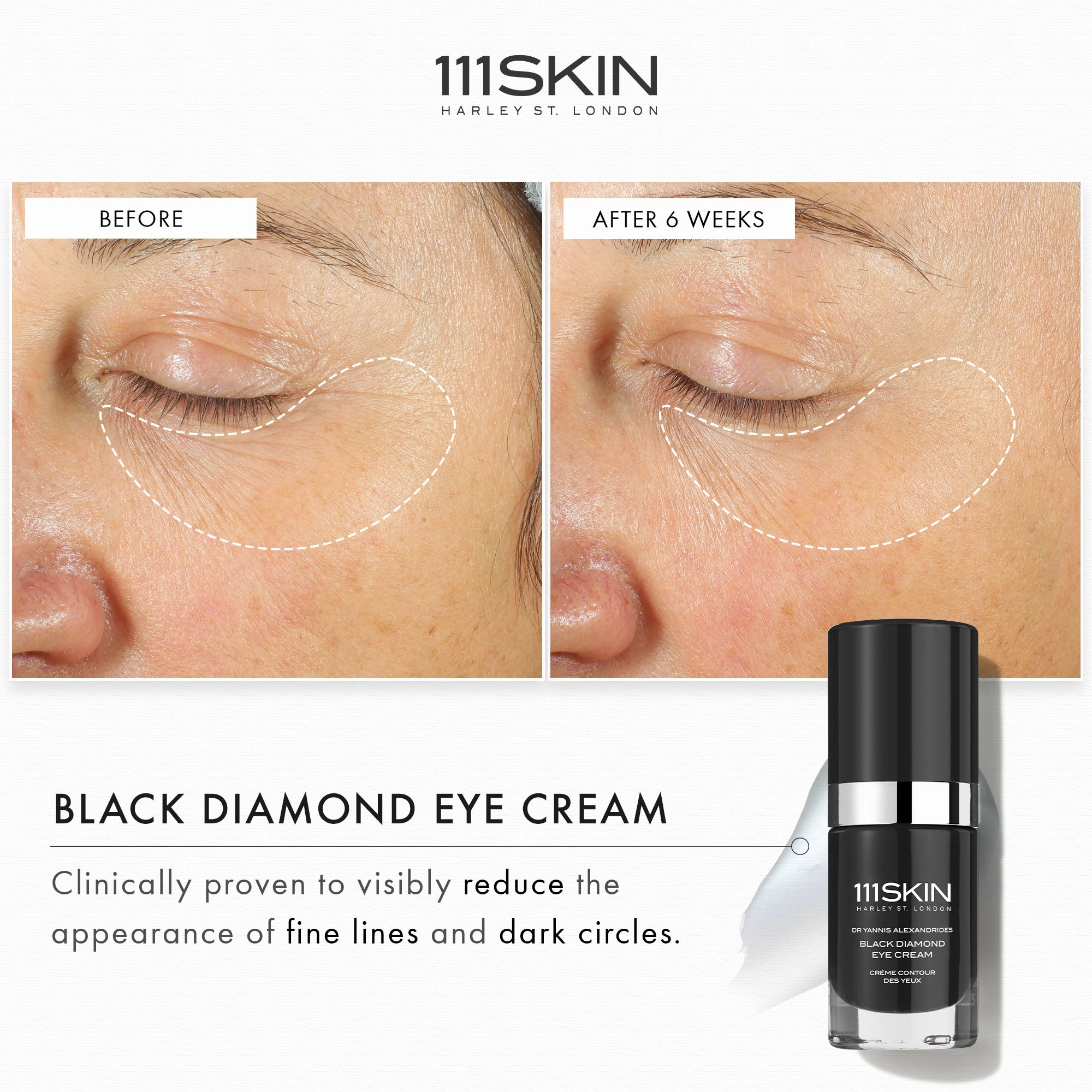 111Skin Black Diamond Eye Cream